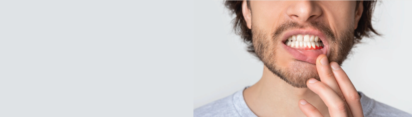 Periodontal Treatment