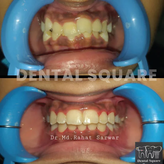 Case-10(dentalsquarebd)