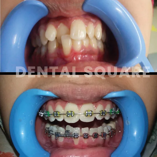 Case-11(dentalsquarebd)