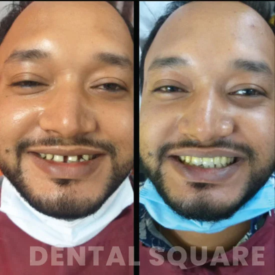 Case-5(dentalsquarebd)