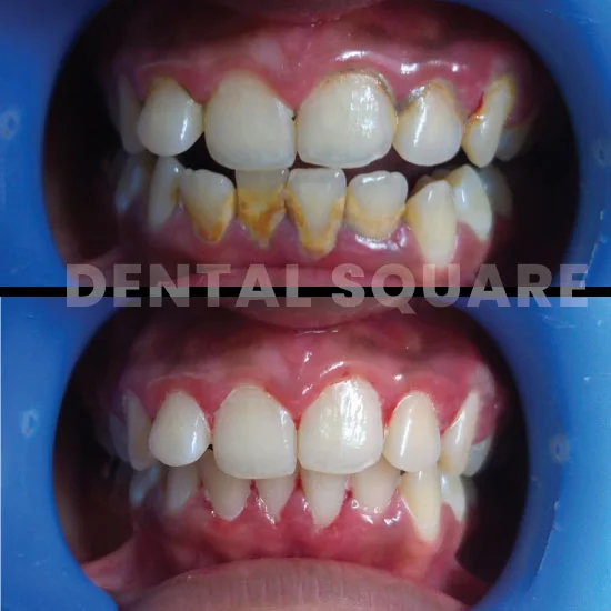 Case-9(dentalsquarebd)